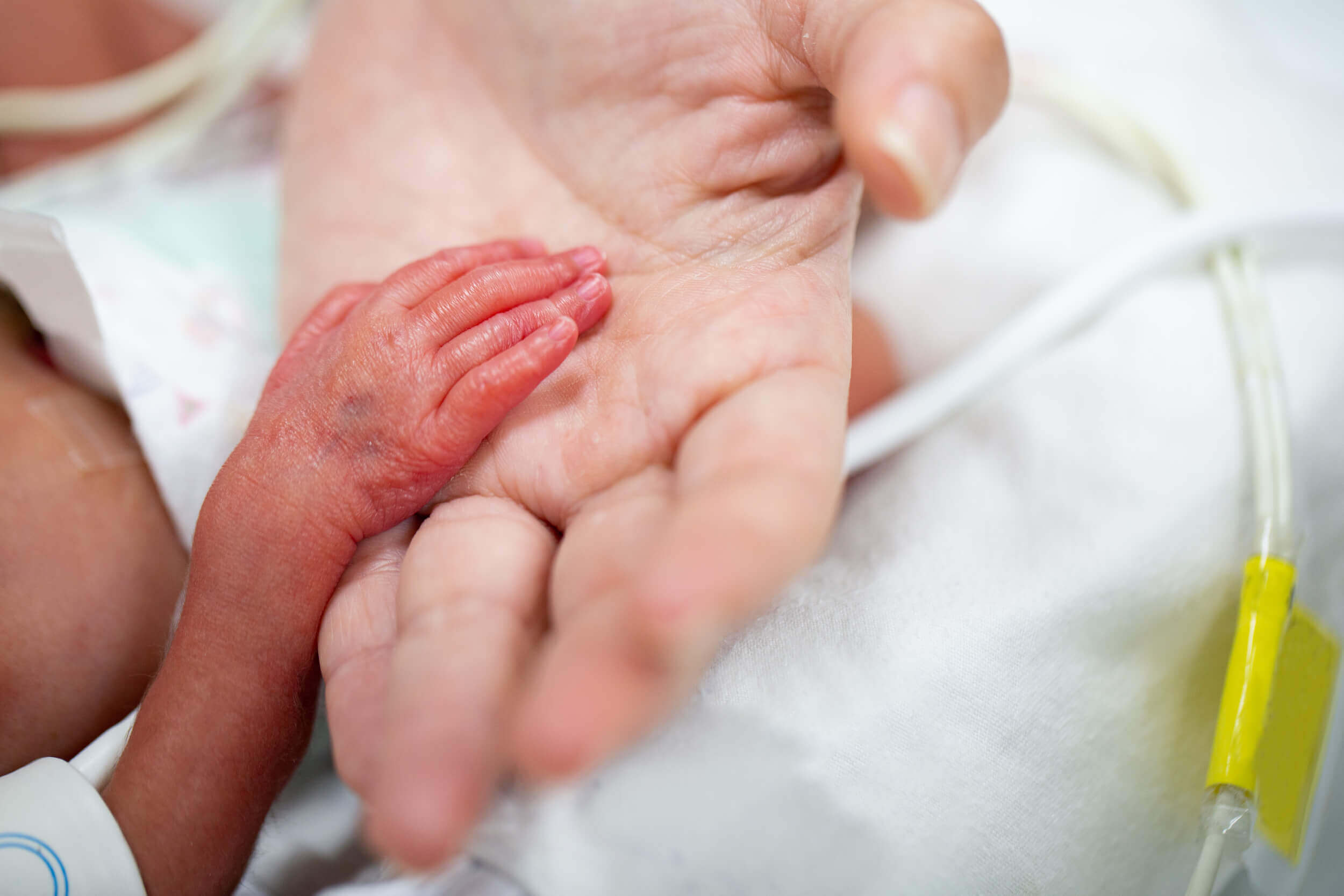 small-baby-hand-with-tubing